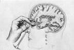 Lobotomy meme sound